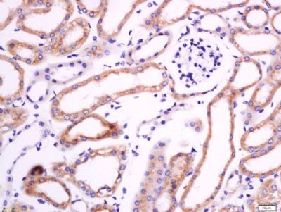 LGR6 Rabbit Polyclonal Antibody