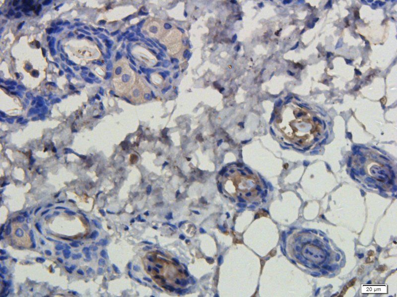 LHCGR antibody