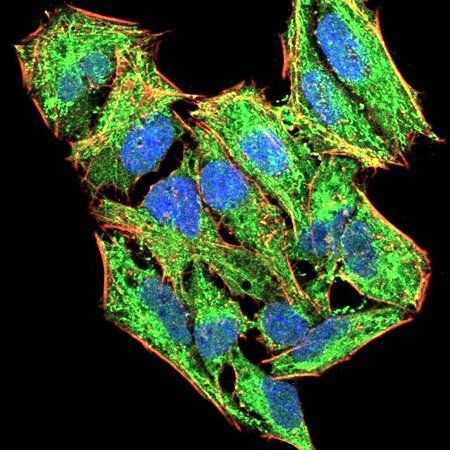 LHCGR Antibody