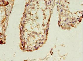 LHCGR Antibody