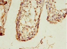 LHCGR antibody