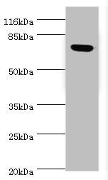 Lhcgr antibody