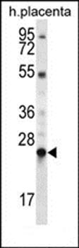 LHFPL1 antibody