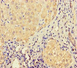 LHFPL1 Antibody