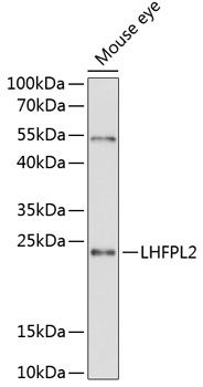 LHFPL2 antibody