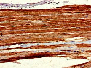 LHFPL5 Antibody