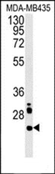 LHPL3 antibody