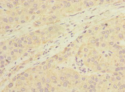LHPP Antibody