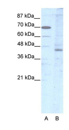 LHX2 antibody