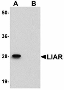 LIAR Antibody