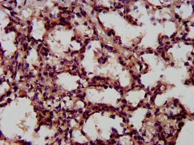 LIFR Antibody