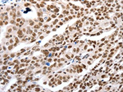 LIFR antibody