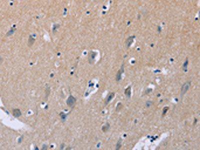 LIFR Antibody