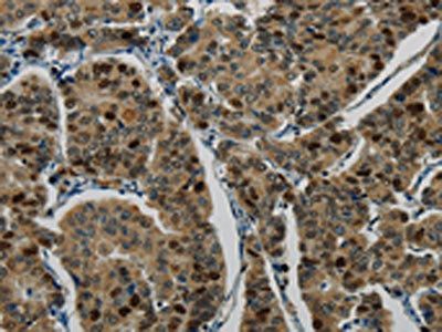 LIG1 Antibody