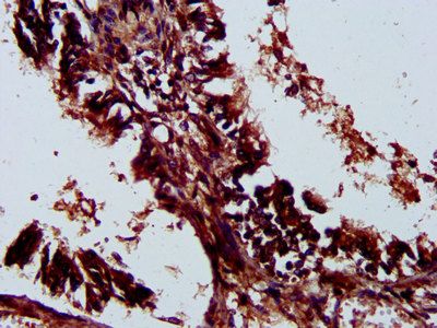 LILRA3 Antibody