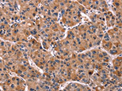 LILRB1 Antibody