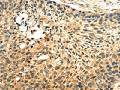 LILRB2 Antibody