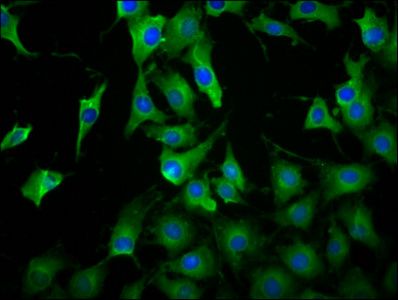 LILRB3 antibody