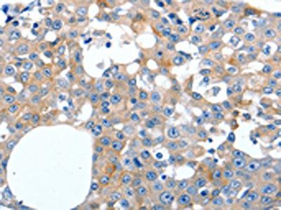 LILRB3 antibody