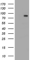 LIM Kinase 1 Antibody