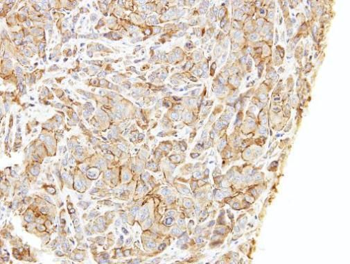 LIMCH1 antibody [C2C3], C-term