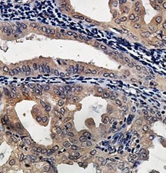 LIMD1 Rabbit Polyclonal Antibody