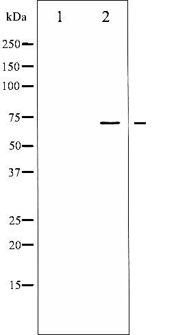 LIMK1/2 (Phospho-Thr508/505) antibody