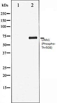LIMk1 (Phospho-Thr508) antibody