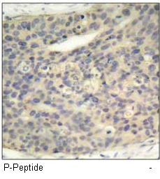 LIMK1 (Phospho-Thr508) Antibody