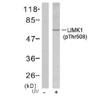 LIMK1 (Phospho-Thr508) Antibody
