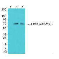 LIMK2 (Ab-283) antibody