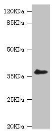 LIMS1 antibody