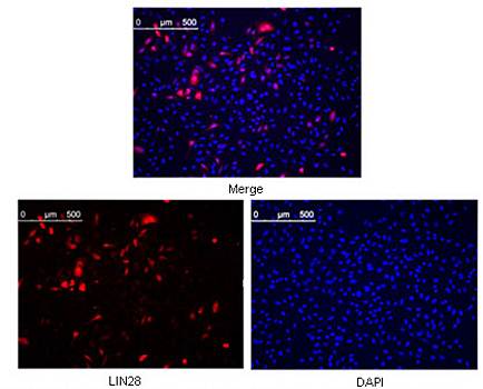 LIN28 Antibody