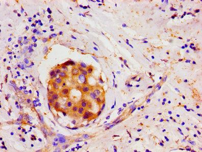 LIN28A Antibody