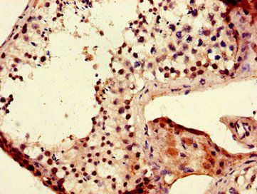 LIN28B Antibody