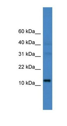 LINC00521 antibody