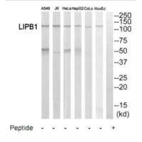 LIPB1 Antibody
