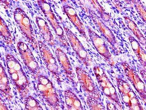 LIPG Antibody