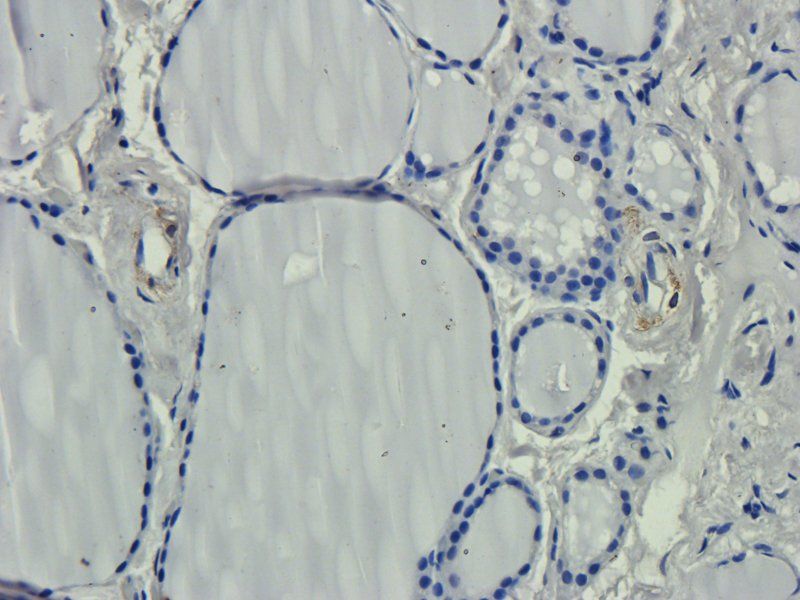 LIPG antibody