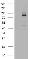 Lipin 2 (LPIN2) antibody