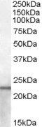 Goat anti-Lipocalin 2 / NGAL (mouse) Antibody