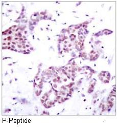 Polyclonal Antibody against Human Lipocalin-2 (LCN2) antibody