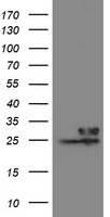 Lipoprotein lipase Antibody