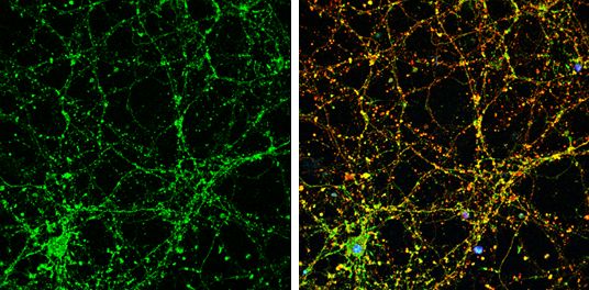 Liprin alpha 1 antibody