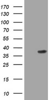 Liprin alpha 1 Antibody