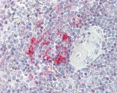 LITAF antibody [N1C3]