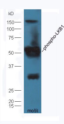 LKB1 (phospho-Ser428) antibody