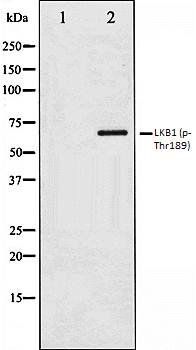 LKB1 (phospho-Thr189) antibody
