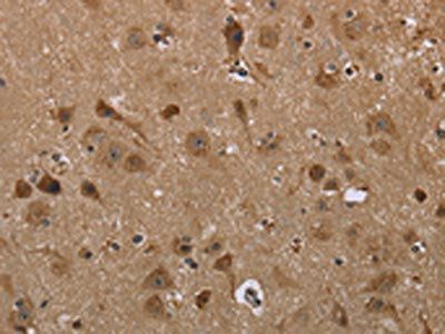 LLGL1 Antibody