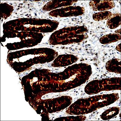 LLGL1 Rabbit Polyclonal Antibody